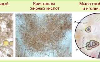 Жирные кислоты в кале у ребенка до года — причины появления и их значение