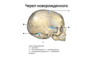 Плоский затылок у грудничка — как исправить проблему правильно