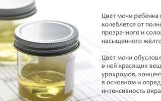 Бесцветная моча у ребенка — почему цвет урины прозрачный и что это значит