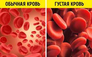 Густая кровь у новорожденного — причины и последствия для здоровья