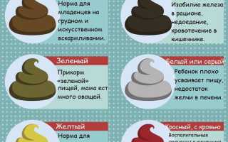 Стул у новорожденных при грудном вскармливании: что нужно знать