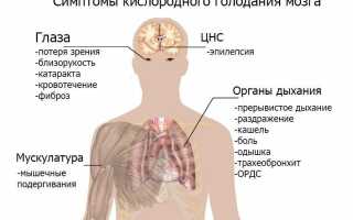 Гипоксия у новорожденных — что это, симптомы, последствия и лечение, важные аспекты