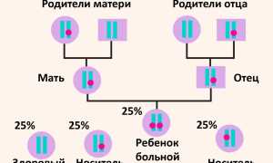 Галактоземия у новорожденных — что это такое, симптомы и лечение