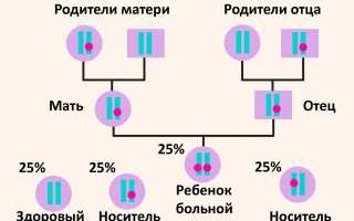 Галактоземия у новорожденных — что это такое, симптомы и лечение