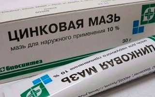 Как вылечить крапивницу раз и навсегда