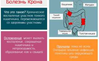 Кровь при дефекации у ребенка до года из заднего прохода после стула: причины и рекомендации