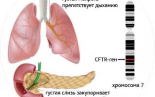 Скрининг из пяточки у новорожденных — зачем проводят анализ в роддоме для здоровья