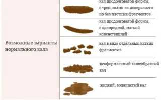 Голодный стул у грудничка — как он выглядит, симптомы и причины
