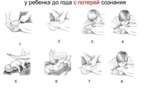 Что делать если ребенок подавился и задыхается в экстренной ситуации