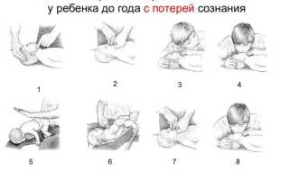 Что делать если ребенок подавился и задыхается в экстренной ситуации