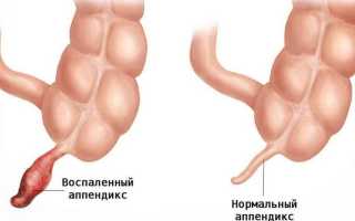 Детские боли в животе, что делать, если у ребенка все болит, советы и рекомендации