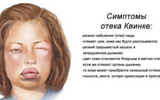 Препараты от отека квинке
