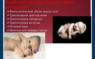 Пограничные состояния новорожденных: краткое описание и их особенности