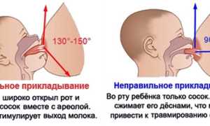 Почему ребенок выгибается во время кормления и что с этим делать