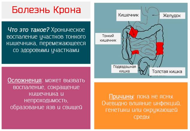 Болезнь Крона