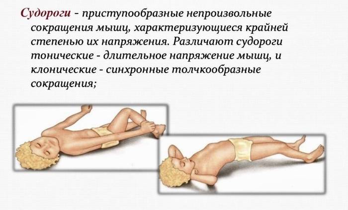 Тонические и клонические спазмы
