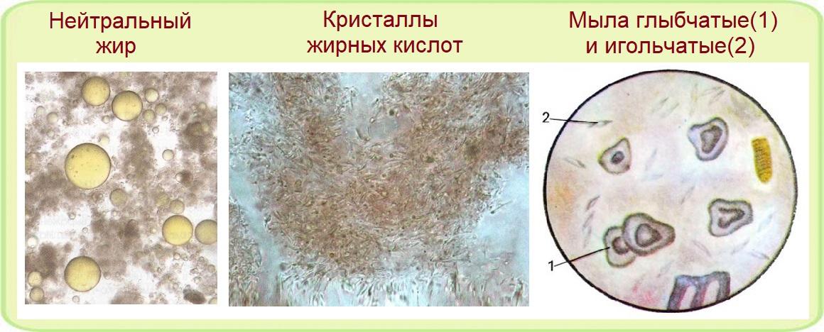 Виды фекальных жиров