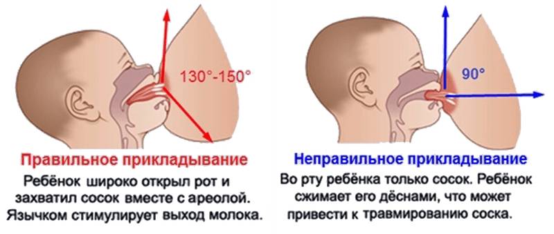 Правильное и неправильное прикладывание младенца к груди