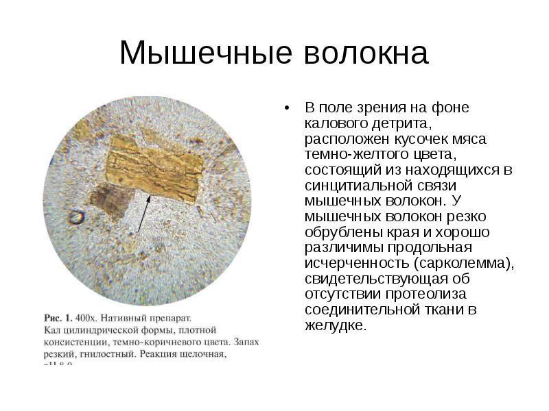 Перевариваемый вид волокон