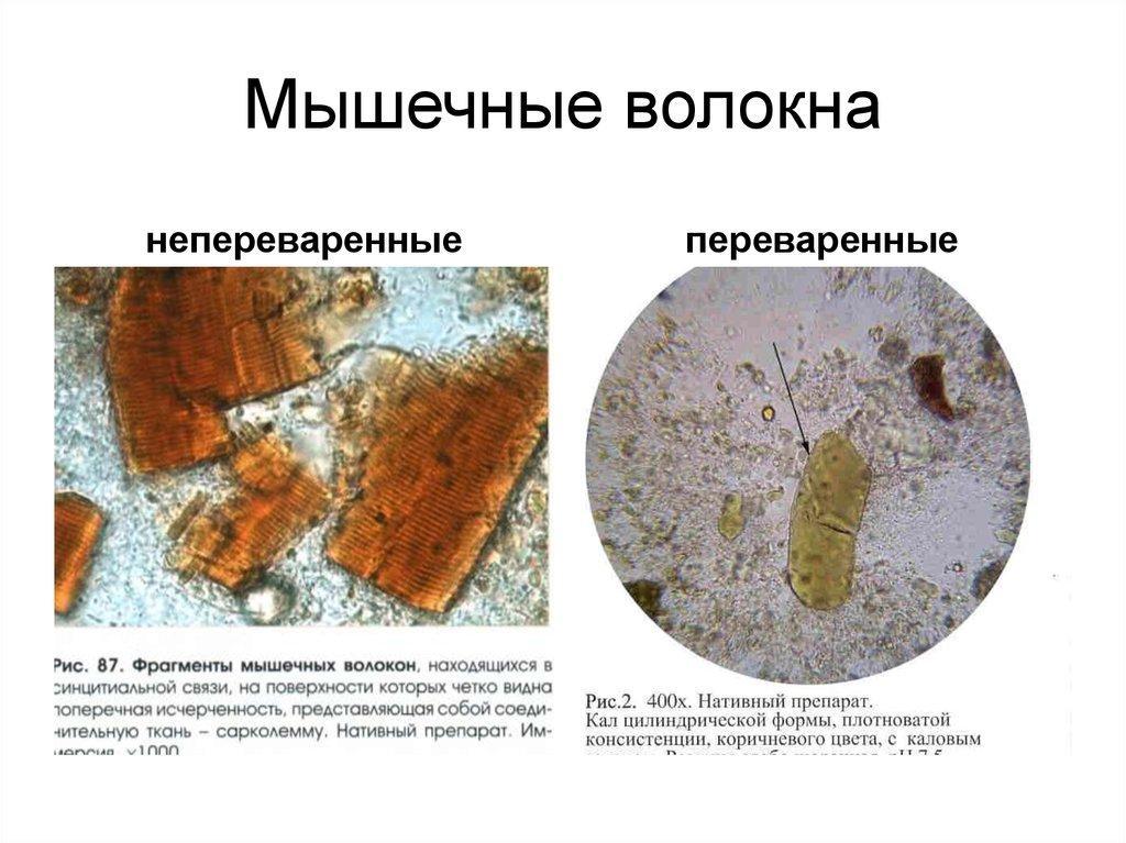 Разновидности мышечных волокон