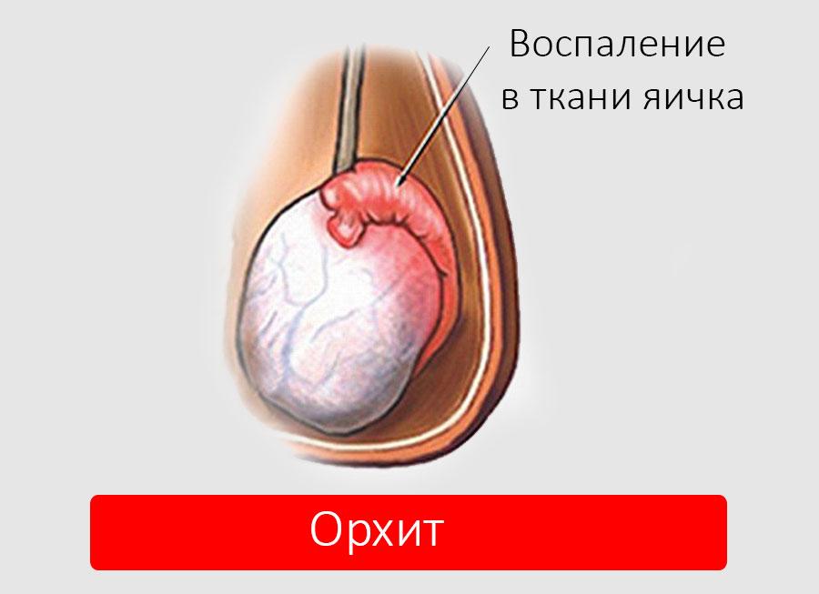 Орхит