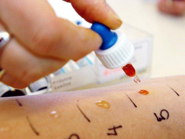Аллергопробы на медикаменты