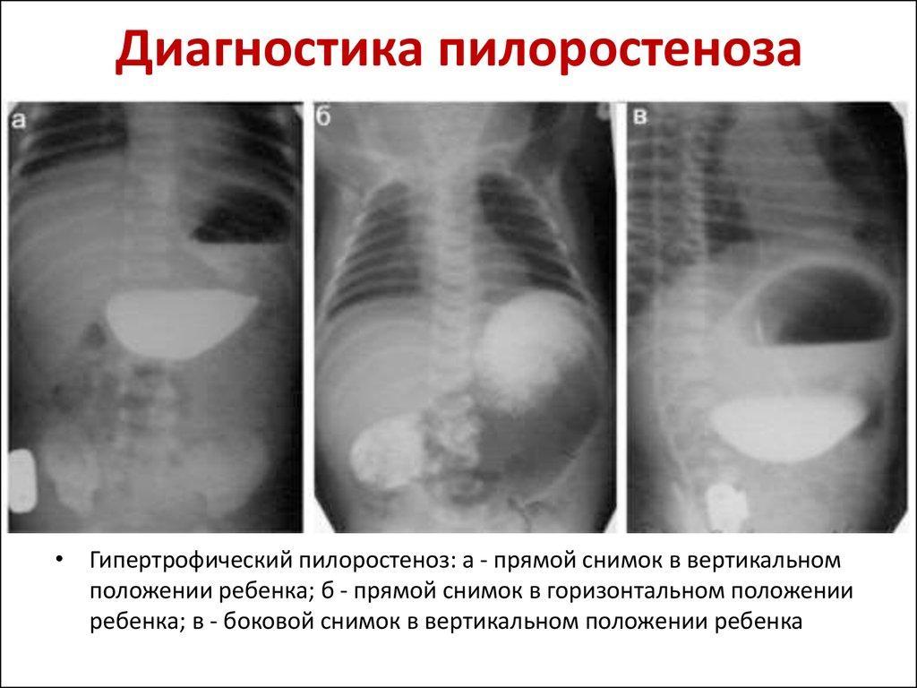 Диагностика