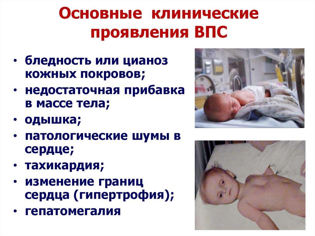 Симптомы ВПС