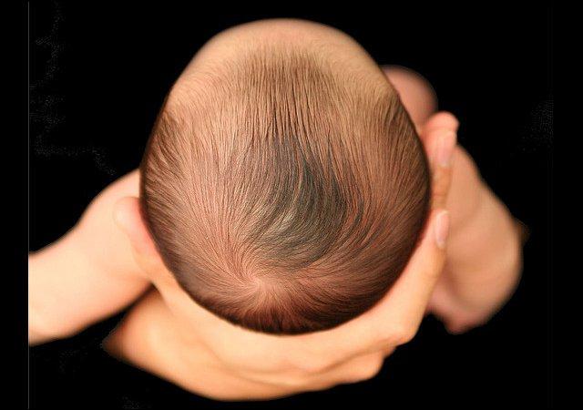 Впалый родничок бывает от обезвоживания