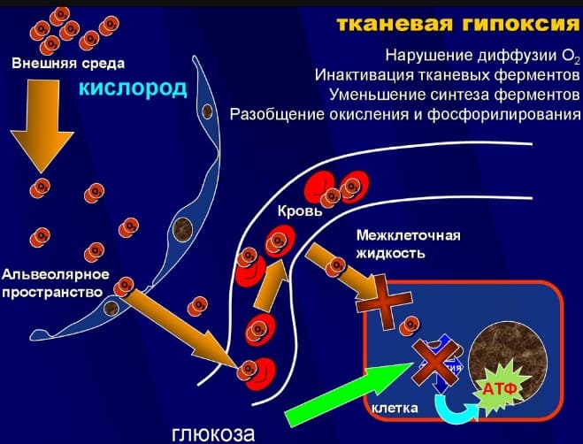 Признаки кислородного голодания органов