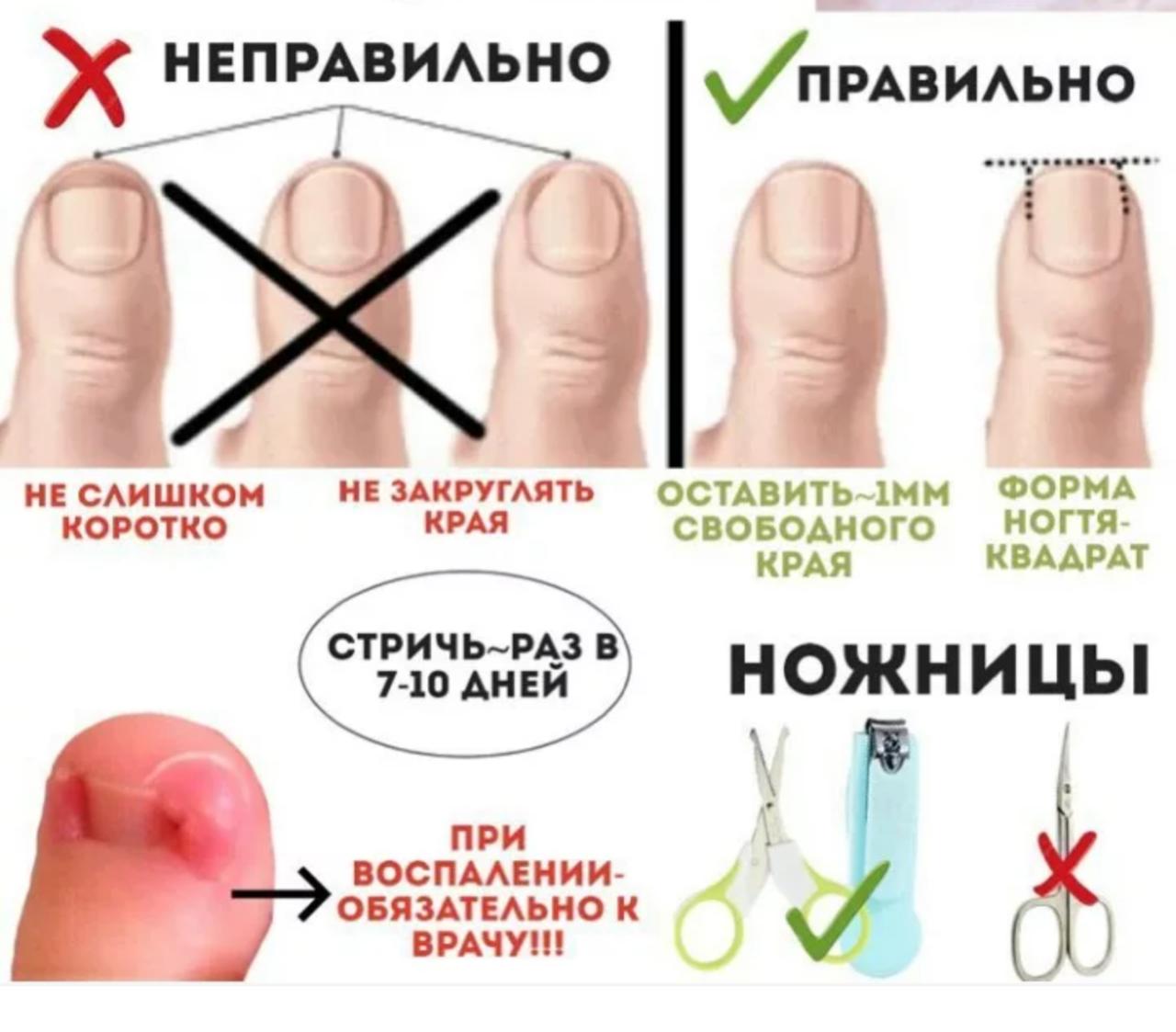 Правила, как стричь ногти