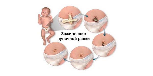 Этапы заживления