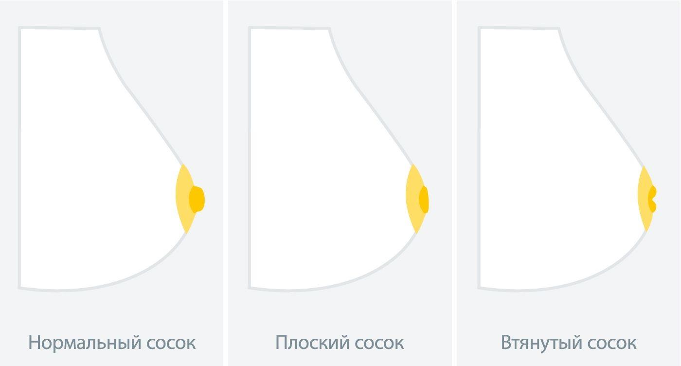 Различные формы сосков