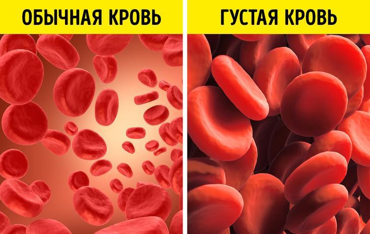 Эритроциты