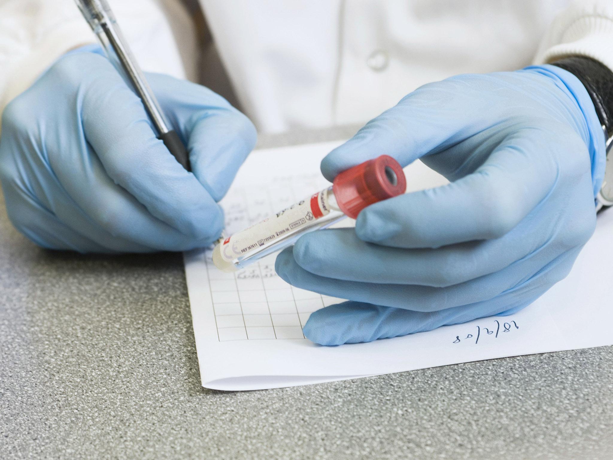 Диагностика шелушения должна проводиться всесторонне