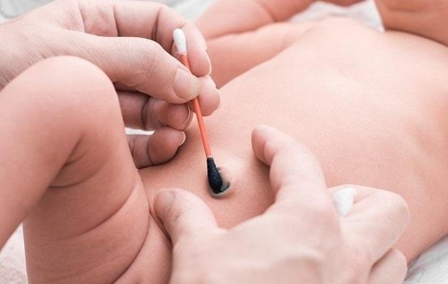 Пупочная ранка новорожденного обрабатывается по определенной технике