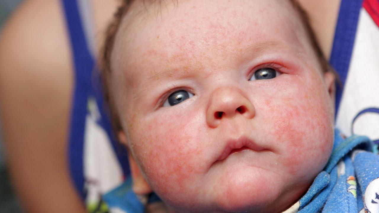 Розовые щечки грудничка