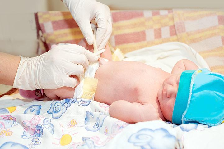 В роддоме обрабатывают пуповинную ранку